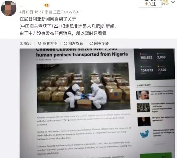 进口丁丁移植把我看傻了
