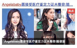 Angelababy医院鉴定整容真人秀必须是有各种公关玄机的！