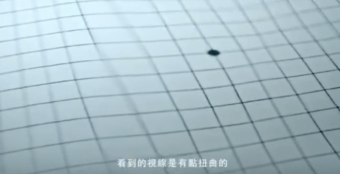 台湾之星公益广告:为何她看到的世界有个“大黑点”?