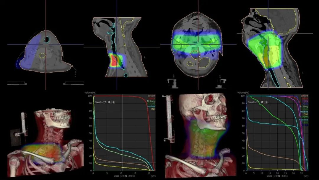 移动DR怎么防护日本最高设计奖GOOD DESIGN AWARD 2021百件获奖作品精彩出炉！_https://www.jmylbn.com_新闻资讯_第37张